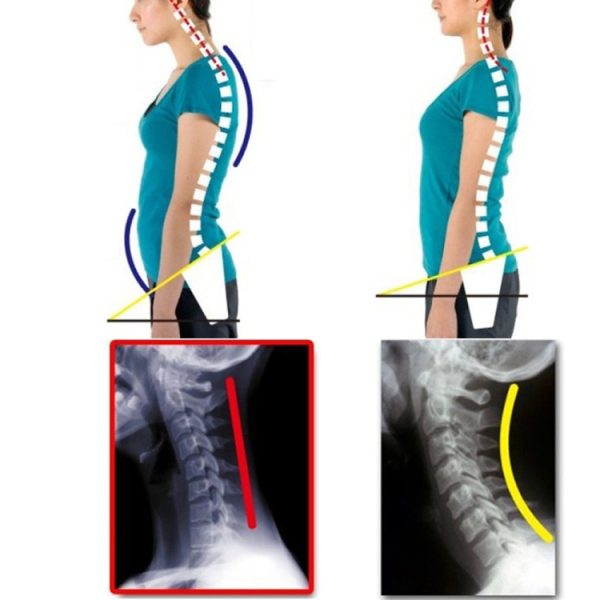 3 PCS Adjustable Shoulder Support Brace Belt - Image 8