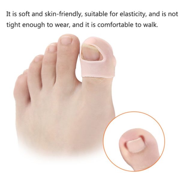 Ingrown Nails Prevent Nails From Growing Flesh Nail Corrections – Image 6